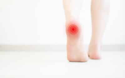 What Is the Fastest Way to Heal a Heel Spur?