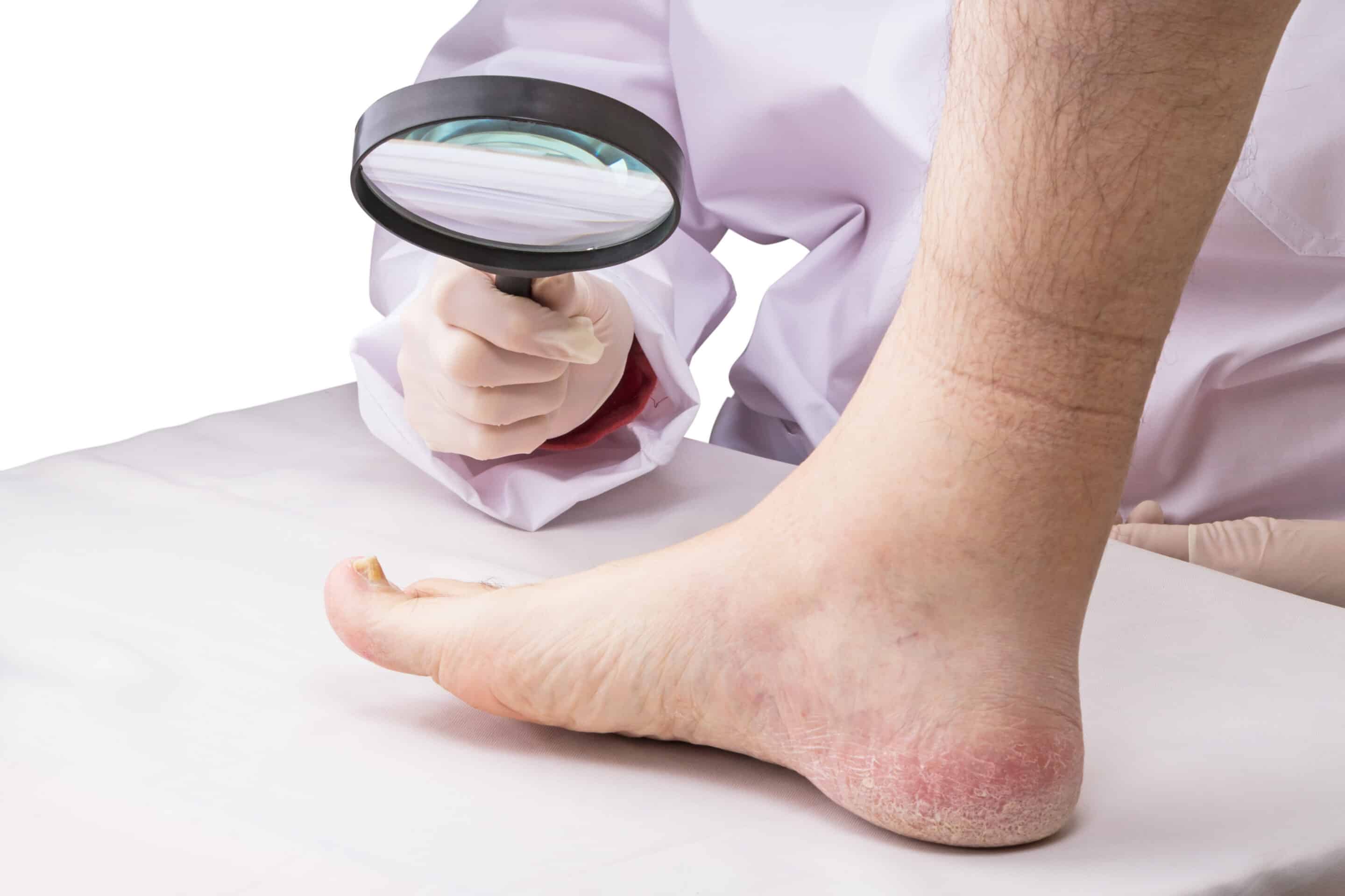 Doctor with magnifying glass and affected leg